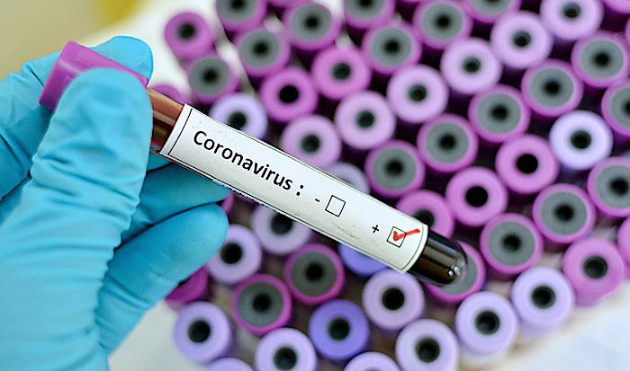Coronavirus